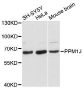 PPM1J Antibody - Western blot analysis of extracts of various cell lines, using PPM1J antibody at 1:3000 dilution. The secondary antibody used was an HRP Goat Anti-Rabbit IgG (H+L) at 1:10000 dilution. Lysates were loaded 25ug per lane and 3% nonfat dry milk in TBST was used for blocking. An ECL Kit was used for detection and the exposure time was 90s.