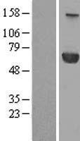 PPM1J Protein - Western validation with an anti-DDK antibody * L: Control HEK293 lysate R: Over-expression lysate
