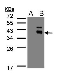 PPM1K Antibody - Western blot of PPM1K expression in transfected 293T cell line by PPM1K polyclonal antibody. A: Non-transfected lysate., B: PPM1K transfected lysate. 12% SDS PAGE. PPM1K antibody diluted at 1:500