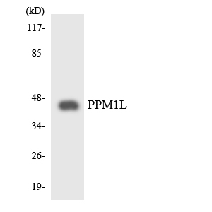 PPM1L Antibody - Western blot analysis of the lysates from HepG2 cells using PPM1L antibody.