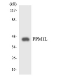 PPM1L Antibody - Western blot analysis of the lysates from HepG2 cells using PPM1L antibody.