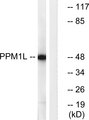 PPM1L Antibody - Western blot analysis of lysates from Jurkat cells, using PPM1L Antibody. The lane on the right is blocked with the synthesized peptide.