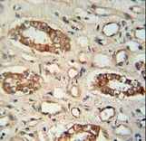PPM1L Antibody - PPM1L antibody immunohistochemistry of formalin-fixed and paraffin-embedded human lung tissue followed by peroxidase-conjugated secondary antibody and DAB staining.