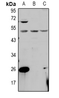 PPM1L Antibody - Western blot analysis of PPM1L expression in AML12 (A), H1792 (B), COS7 (C) whole cell lysates.