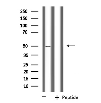 PPM1L Antibody - Western blot analysis of extracts of Jurkat cells using PPM1L antibody.