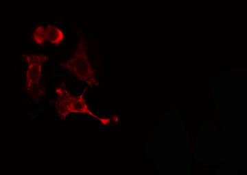 PPM1L Antibody - Staining HeLa cells by IF/ICC. The samples were fixed with PFA and permeabilized in 0.1% Triton X-100, then blocked in 10% serum for 45 min at 25°C. The primary antibody was diluted at 1:200 and incubated with the sample for 1 hour at 37°C. An Alexa Fluor 594 conjugated goat anti-rabbit IgG (H+L) antibody, diluted at 1/600, was used as secondary antibody.