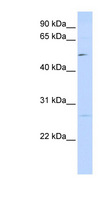 PPM1M Antibody - PPM1M antibody Western blot of 293T cell lysate. This image was taken for the unconjugated form of this product. Other forms have not been tested.