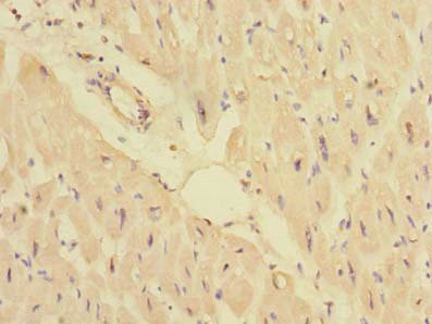 PPM1M Antibody - Immunohistochemistry of paraffin-embedded human heart tissue using PPM1M Antibody at dilution of 1:100