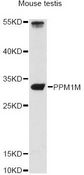 PPM1M Antibody - Western blot analysis of extracts of mouse testis, using PPM1M antibody at 1:3000 dilution. The secondary antibody used was an HRP Goat Anti-Rabbit IgG (H+L) at 1:10000 dilution. Lysates were loaded 25ug per lane and 3% nonfat dry milk in TBST was used for blocking. An ECL Kit was used for detection and the exposure time was 90s.