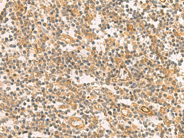 PPM1M Antibody - Immunohistochemistry of paraffin-embedded Human tonsil tissue  using PPM1M Polyclonal Antibody at dilution of 1:100(×200)