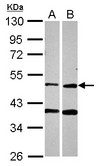 PPOX Antibody - Sample (30 ug of whole cell lysate) A: A549 B: HCT116 10% SDS PAGE PPOX antibody diluted at 1:2000
