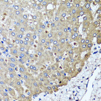 PPOX Antibody - Immunohistochemistry of paraffin-embedded human liver injury tissue.