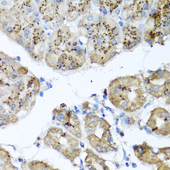 PPOX Antibody - Immunohistochemistry of paraffin-embedded human stomach tissue.