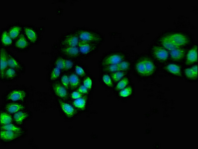 PPOX Antibody - Immunofluorescent analysis of PC-3 cells using PPOX Antibody at dilution of 1:100 and Alexa Fluor 488-congugated AffiniPure Goat Anti-Rabbit IgG(H+L)
