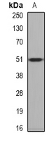 PPOX Antibody - Western blot analysis of PPOX expression in U2OS (A) whole cell lysates.