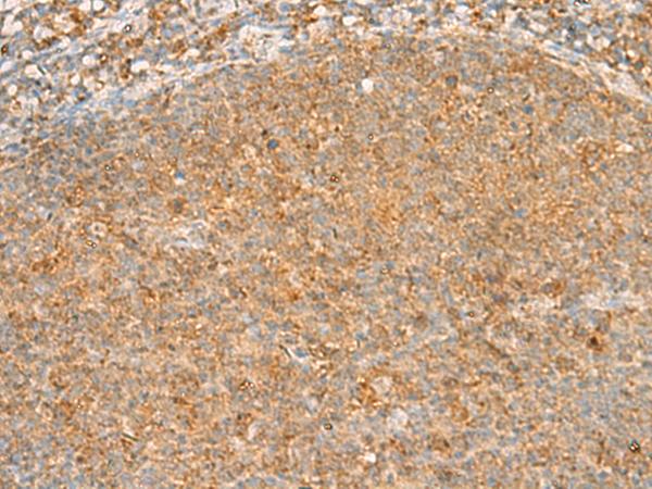 PPOX Antibody - Immunohistochemistry of paraffin-embedded Human tonsil tissue  using PPOX Polyclonal Antibody at dilution of 1:30(×200)