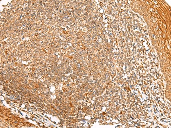 PPOX Antibody - Immunohistochemistry of paraffin-embedded Human tonsil tissue  using PPOX Polyclonal Antibody at dilution of 1:45(×200)