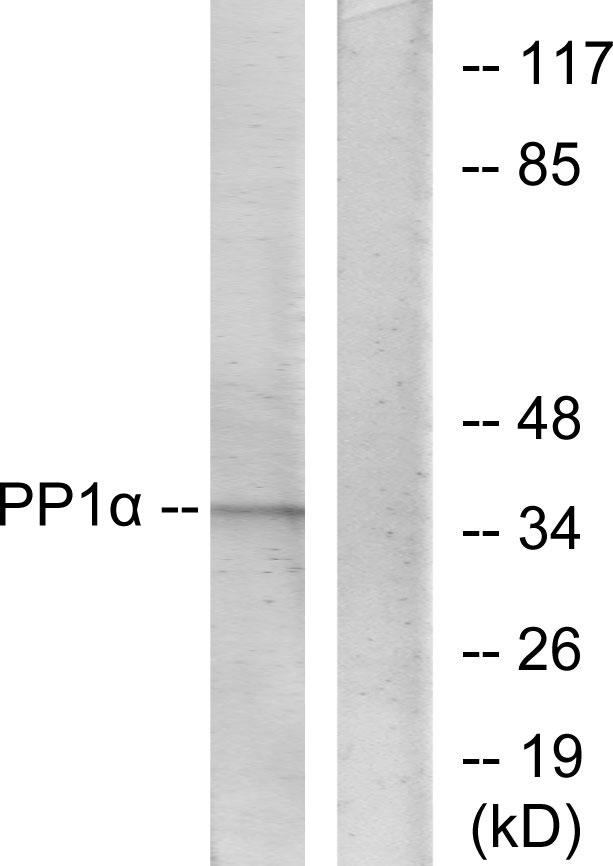 PPP1CA / PP1-Alpha Antibody - Western blot analysis of lysates from Jurkat cells, using PP1-alpha Antibody. The lane on the right is blocked with the synthesized peptide.