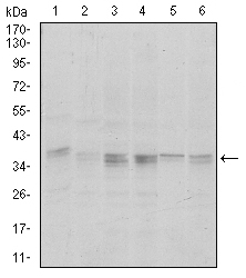 PPP1CA / PP1-Alpha Antibody - Western blot using PPP1CA mouse monoclonal antibody against HeLa (1), HepG2 (2), MCF-7 (3), Jurkat (4) and A549 (5) cell lysate.