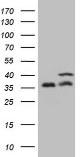 PPP1CA / PP1-Alpha Antibody - HEK293T cells were transfected with the pCMV6-ENTRY control. (Left lane) or pCMV6-ENTRY PPP1CA. (Right lane) cDNA for 48 hrs and lysed. Equivalent amounts of cell lysates. (5 ug per lane) were separated by SDS-PAGE and immunoblotted with anti-PPP1CA. (1:2000)