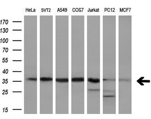 PPP1CA / PP1-Alpha Antibody - Western blot analysis of extracts. (10ug) from 7 different cell lines by using anti-PPP1CA monoclonal antibody. (1:200)
