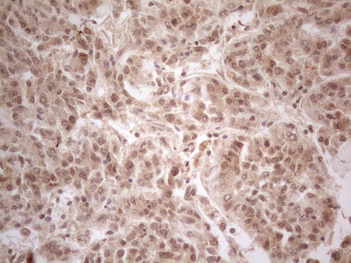 PPP1CA / PP1-Alpha Antibody - Immunohistochemical staining of paraffin-embedded Human liver tissue using anti-PPP1CA mouse monoclonal antibody. (Heat-induced epitope retrieval by 1mM EDTA in 10mM Tris buffer. (pH8.5) at 120°C for 3 min. (1:150)