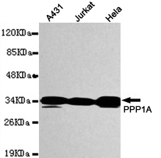 PPP1CA / PP1-Alpha Antibody - Western blot detection of PPP1A in MCF7, K562, HeLa, HEPG2 and Jurkat whole cell lysates using PPP1A mouse monoclonal antibody (1:1000 dilution). Predicted band size: 38KDa. Observed band size: 38KDa.