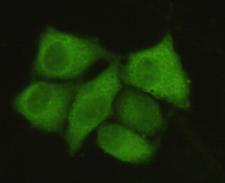 PPP1CA / PP1-Alpha Antibody - Immunocytochemistry of HeLa cells using anti-PPP1A mouse monoclonal antibody diluted 1:50.