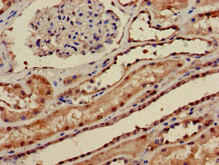 PPP1CA / PP1-Alpha Antibody - Immunohistochemistry of paraffin-embedded human kidney tissue at dilution of 1:100