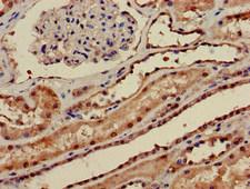PPP1CA / PP1-Alpha Antibody - Immunohistochemistry of paraffin-embedded human kidney tissue at dilution of 1:100