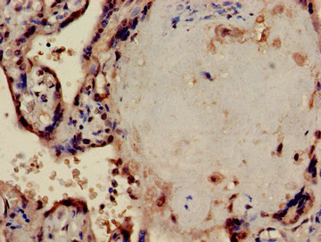 PPP1CA / PP1-Alpha Antibody - Immunohistochemistry of paraffin-embedded human placenta tissue at dilution of 1:100