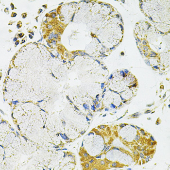 PPP1CA / PP1-Alpha Antibody - Immunohistochemistry of paraffin-embedded human esophagus using PPP1CA antibody at dilution of 1:100 (40x lens).