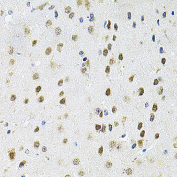 PPP1CA / PP1-Alpha Antibody - Immunohistochemistry of paraffin-embedded mouse brain using PPP1CA antibody at dilution of 1:100 (40x lens).