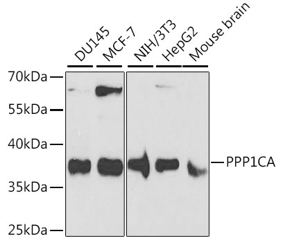 PPP1CA / PP1-Alpha Antibody - Western blot analysis of extracts of various cell lines, using PPP1CA antibody at 1:1000 dilution. The secondary antibody used was an HRP Goat Anti-Rabbit IgG (H+L) at 1:10000 dilution. Lysates were loaded 25ug per lane and 3% nonfat dry milk in TBST was used for blocking. An ECL Kit was used for detection.