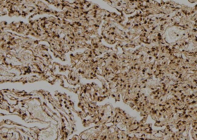 PPP1CA / PP1-Alpha Antibody - 1:100 staining human lung tissue by IHC-P. The sample was formaldehyde fixed and a heat mediated antigen retrieval step in citrate buffer was performed. The sample was then blocked and incubated with the antibody for 1.5 hours at 22°C. An HRP conjugated goat anti-rabbit antibody was used as the secondary.