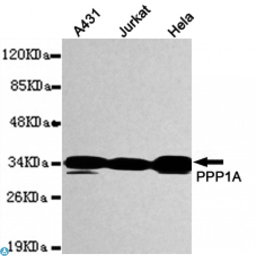 PPP1CA / PP1-Alpha Antibody - Western blot detection of PPP1A in A431, Jurkat and HeLa cell lysates using PPP1A mouse mAb (1:1000 diluted). Predicted band size: 38KDa. Observed band size: 38KDa.
