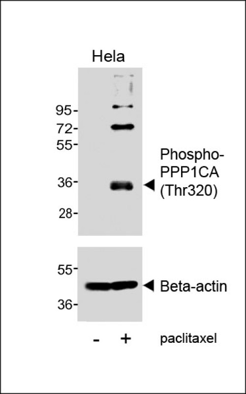 PPP1CA / PP1-Alpha Antibody - Western blot analysis of lysates from Hela cell line, untreated or treated with paclitaxel, 100nM, 20hrs, using Phospho-PPP1CA (Thr320) Antibody (upper) or Beta-actin (lower).