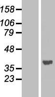 PPP1CA / PP1-Alpha Protein - Western validation with an anti-DDK antibody * L: Control HEK293 lysate R: Over-expression lysate