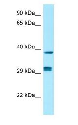 PPP1CB Antibody - PPP1CB antibody Western Blot of Fetal Kidney.  This image was taken for the unconjugated form of this product. Other forms have not been tested.