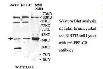 PPP1CB Antibody