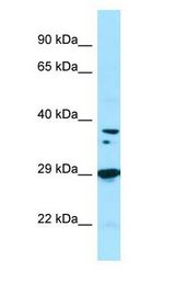 PPP1CB Antibody - PPP1CB antibody Western Blot of Fetal Liver.  This image was taken for the unconjugated form of this product. Other forms have not been tested.