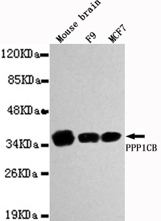 PPP1CB Antibody - Western blot detection of PPP1CB in Mouse brain,F9&MCF7 cell lysates using PPP1CB antibody (1:1000 diluted).