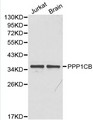 PPP1CB Antibody - Western blot of PPP1CB pAb in extracts from Jurkat cells and mouse brain tissue.