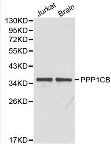 PPP1CB Antibody - Western blot of PPP1CB pAb in extracts from Jurkat cells and mouse brain tissue.