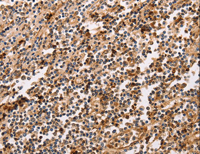 PPP1CB Antibody - Immunohistochemistry of paraffin-embedded Human tonsil using PPP1CB Polyclonal Antibody at dilution of 1:30.