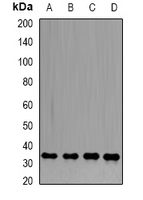 PPP1CB Antibody - Western blot analysis of PP1 beta expression in HL60 (A); PC3 (B); HeLa (C); mouse heart (D) whole cell lysates.