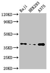 PPP1CB Antibody - Western Blot Positive WB detected in:Raji whole cell lysate,HEK293 whole cell lysate,A375 whole cell lysate All Lanes:Ppp1cb antibody at 3.5µg/ml Secondary Goat polyclonal to rabbit IgG at 1/50000 dilution Predicted band size: 38 KDa Observed band size: 38 KDa
