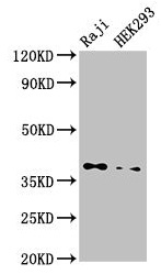 PPP1CB Antibody - Western Blot Positive WB detected in: Raji whole cell lysate, HEK293 whole cell lysate All lanes: PPP1CB antibody at 3.5µg/ml Secondary Goat polyclonal to rabbit IgG at 1/50000 dilution Predicted band size: 38 kDa Observed band size: 38 kDa