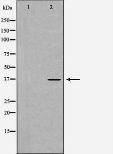 PPP1CB Antibody - Western blot analysis of Jurkat cells using PPP1CB antibody. The lane on the left is treated with the antigen-specific peptide.
