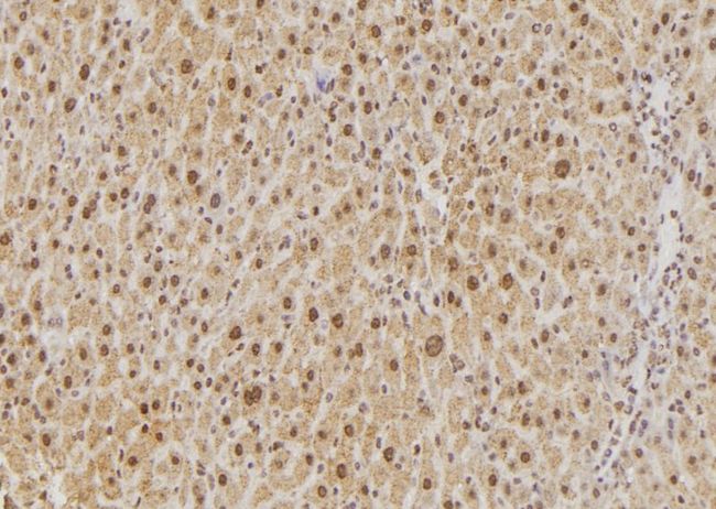 PPP1CB Antibody - 1:100 staining rat liver tissue by IHC-P. The sample was formaldehyde fixed and a heat mediated antigen retrieval step in citrate buffer was performed. The sample was then blocked and incubated with the antibody for 1.5 hours at 22°C. An HRP conjugated goat anti-rabbit antibody was used as the secondary.